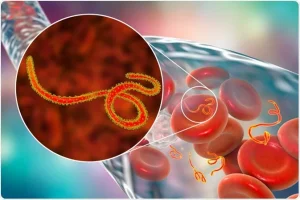 Ebola