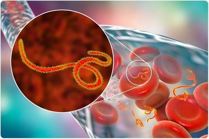 Ebola
